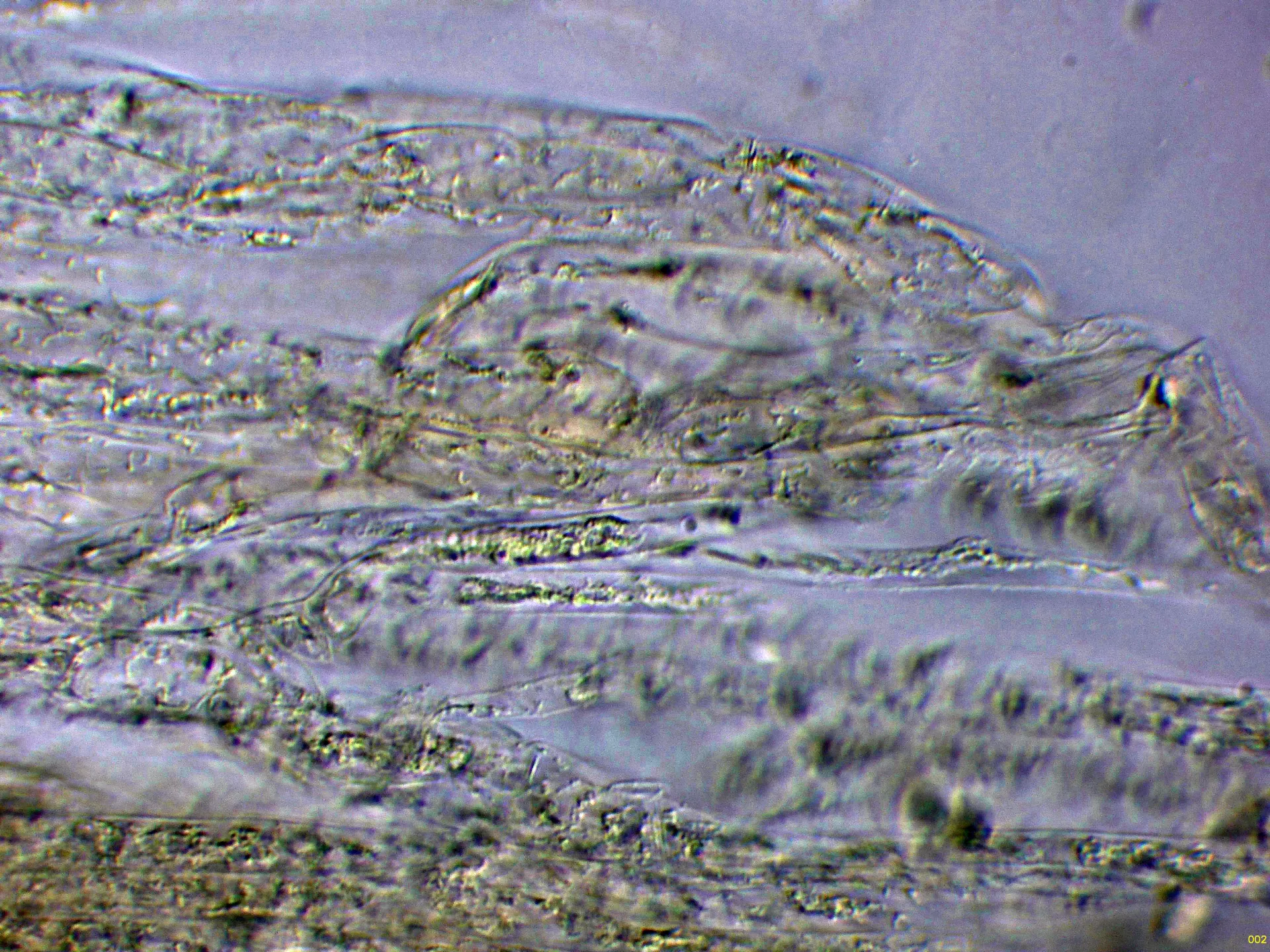 Microscopía de Limacella subtropicana - 10 - Suprapellis Melzer-002